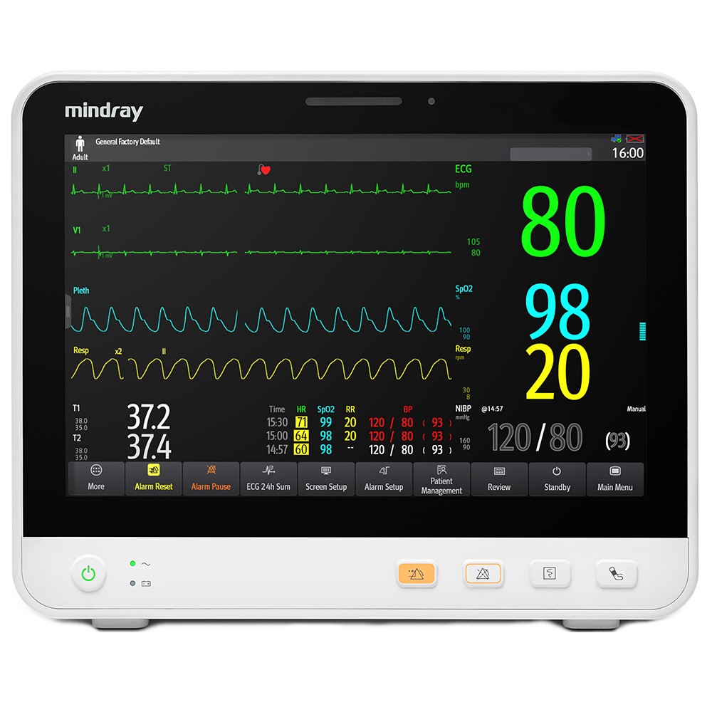 Монитор пациента mindray. Mindray EPM 12m. Epm12 Mindray. Монитор пациента Mindray epm10. Прикроватный монитор пациента Миндрей.