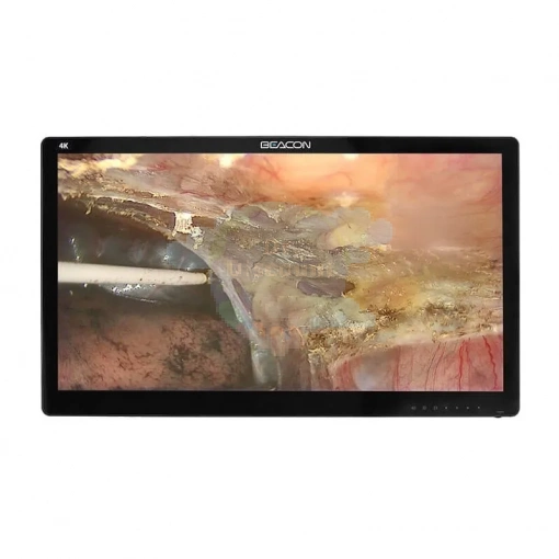 Хирургический монитор сверхвысокой четкости S3282P