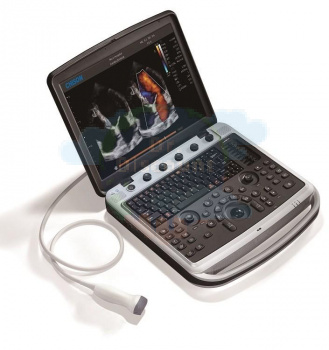 УЗИ аппарат CHISON SonoTouch 80 Expert (Sonobook 9)